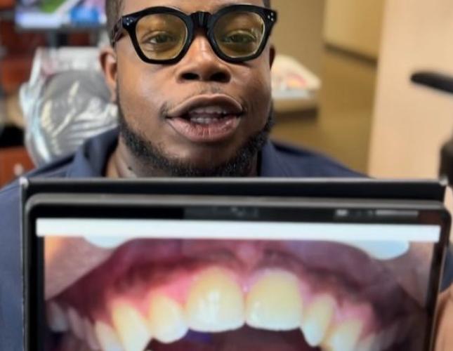 Invisalign 1 before