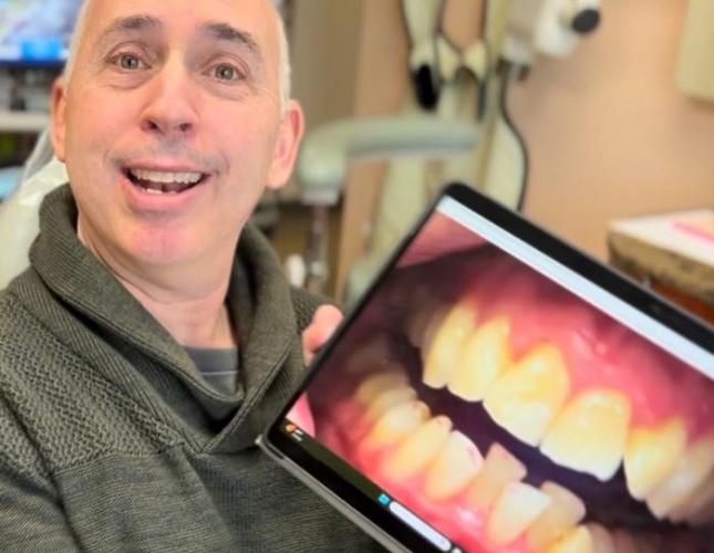 Invisalign 2 before
