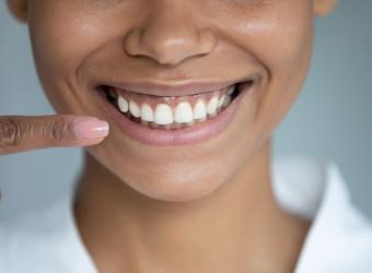 Gum Disease: A &quot;Sneaky&quot; Yet Preventable Health Issue